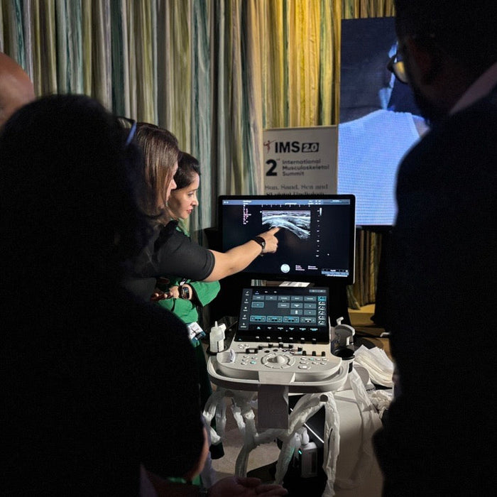 Where AI Meets Ultrasound: The Power Behind SonoScape S80 Elite